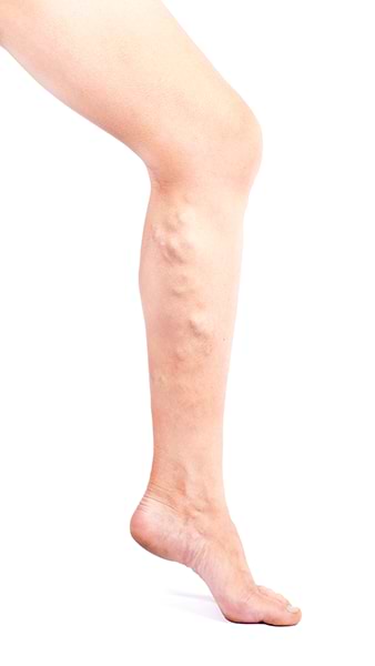 Como mejorar la circulación sanguínea en las piernas - Nahrin